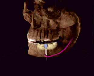 We are the experts of dental implants.