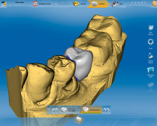 We are the best at dental implant design.