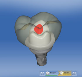 We are the best dentistry for dental implants.