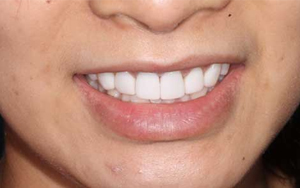 We create a beautiful smile just for you.
