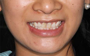 We are the best dentistry to correct your teeth.