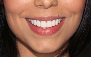 We are the best in teeth whitening here in Sydney.