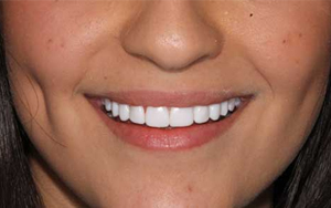 We are the best dentistry in Sydney.
