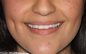 We are the best dentistry to correct your teeth.