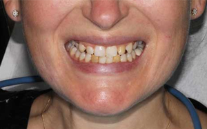 We are the best dentistry to correct your teeth.