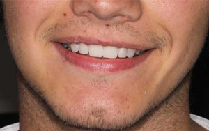 We make sure you'll get what you want for your teeth.