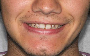 We make sure you'll get a good set of teeth.
