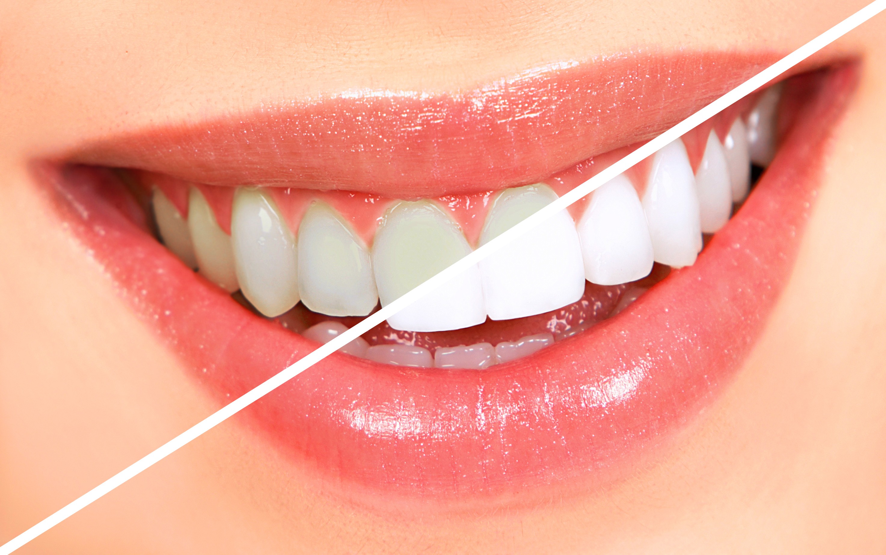 We are the best dentistry for teeth whitening.