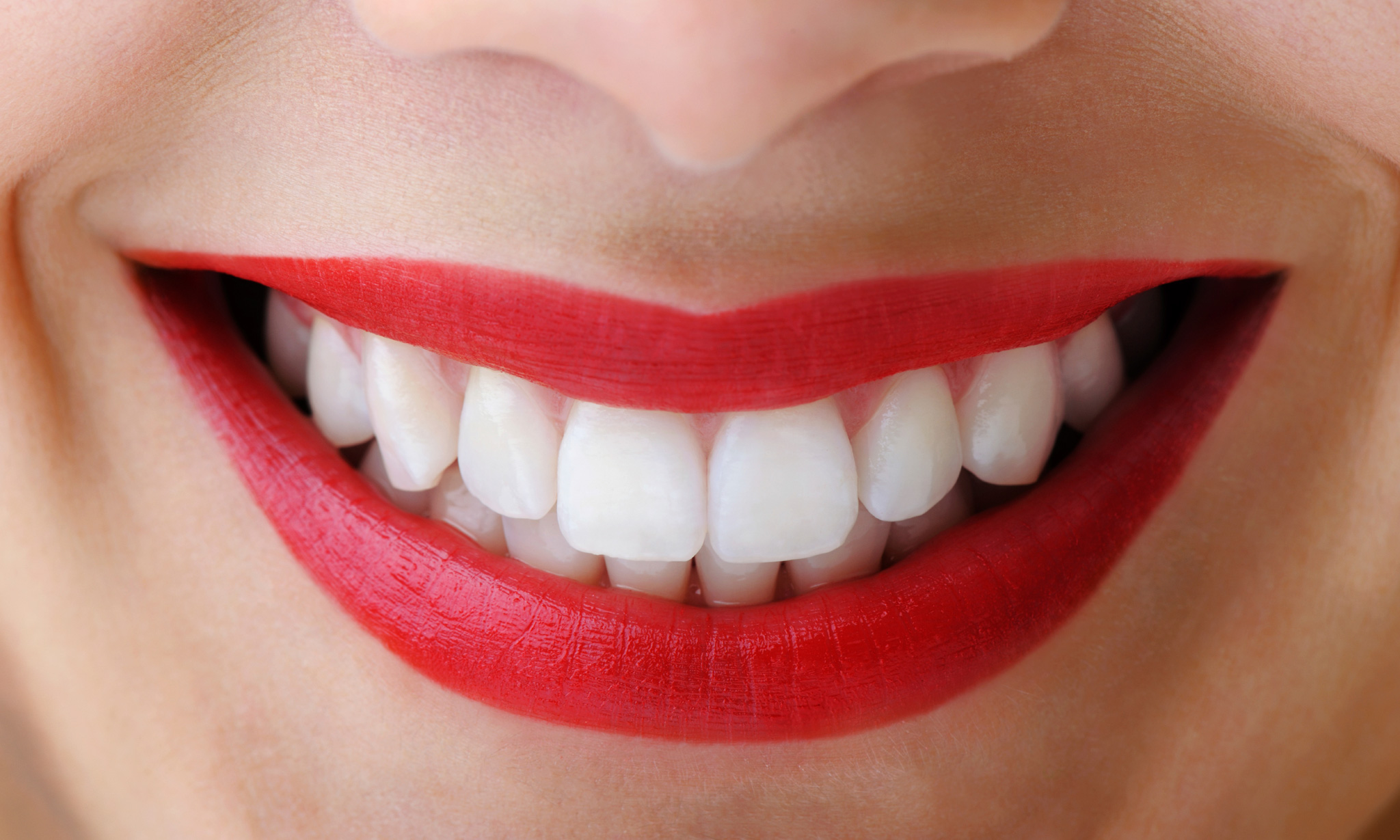 We are the experts when it comes to teeth whitening here in Sydney.