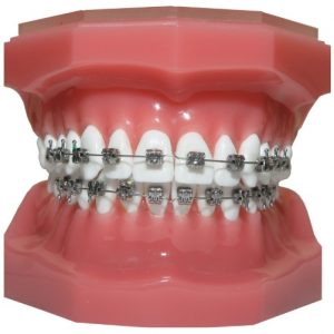 We provide orthodontic treatment here in Sydney.