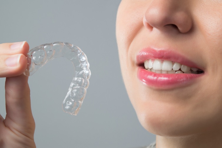 Invisalign cost here in Sydney.