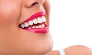 We offer affordable teeth whitening service here in our Sydney clinic.