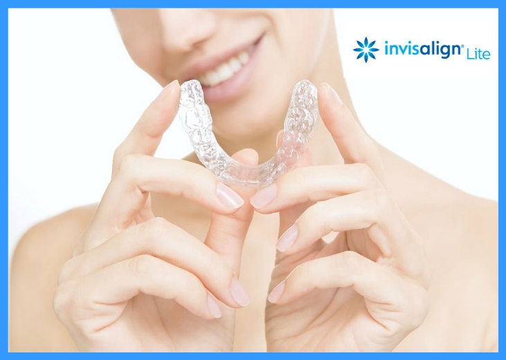 Invisalign Lite