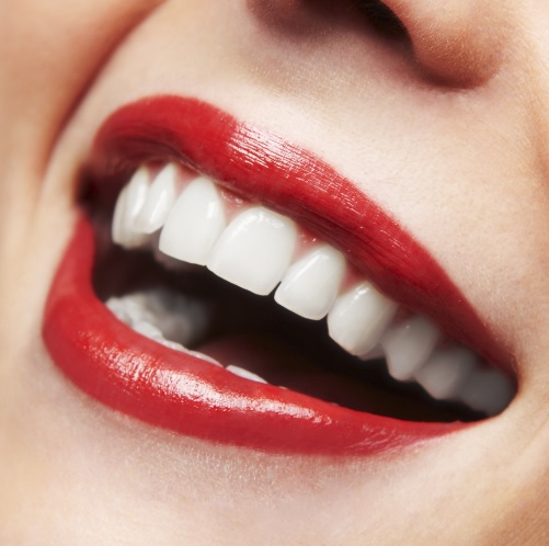 We provide affordable teeth whitening here in Sydney.