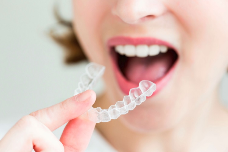 We are a platinum provider of Invisalign here in Sydney.