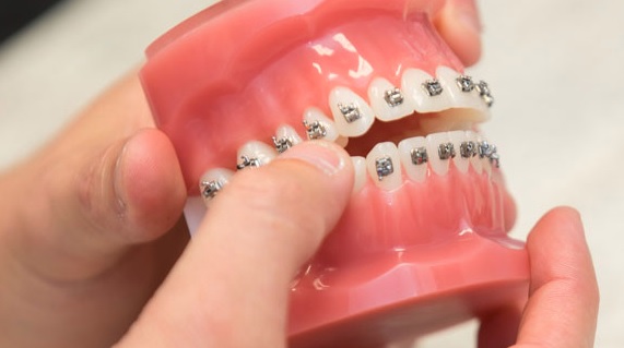 We are the best in Orthodontics here in Sydney