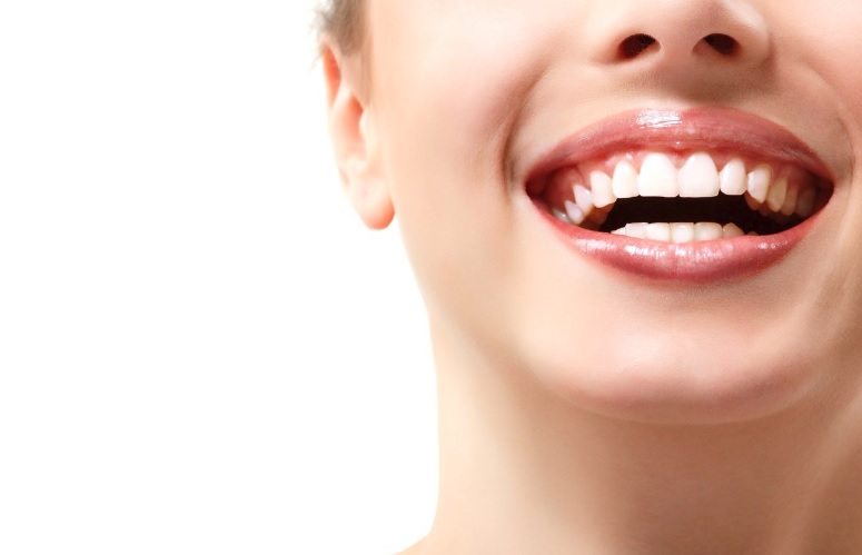 Professional Teeth Whitening in Sydney