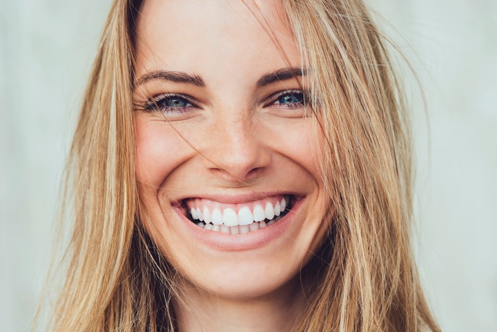 Dental veneers in Sydney