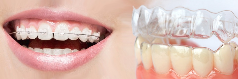 Orthodontics in Sydney