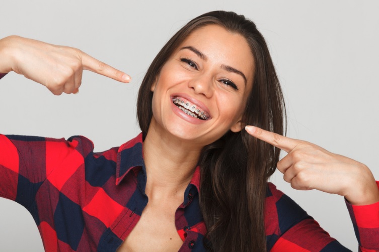 Braces Cost in Sydney