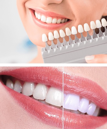 Cosmetic Dentistry Services in Sydney