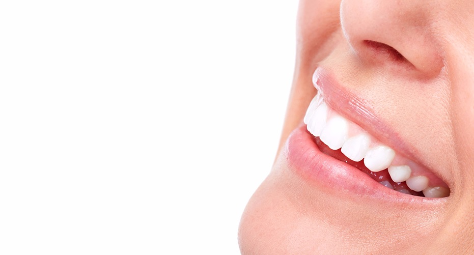 Teeth Whitening in Sydney