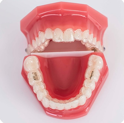 Invisalign in Sydney