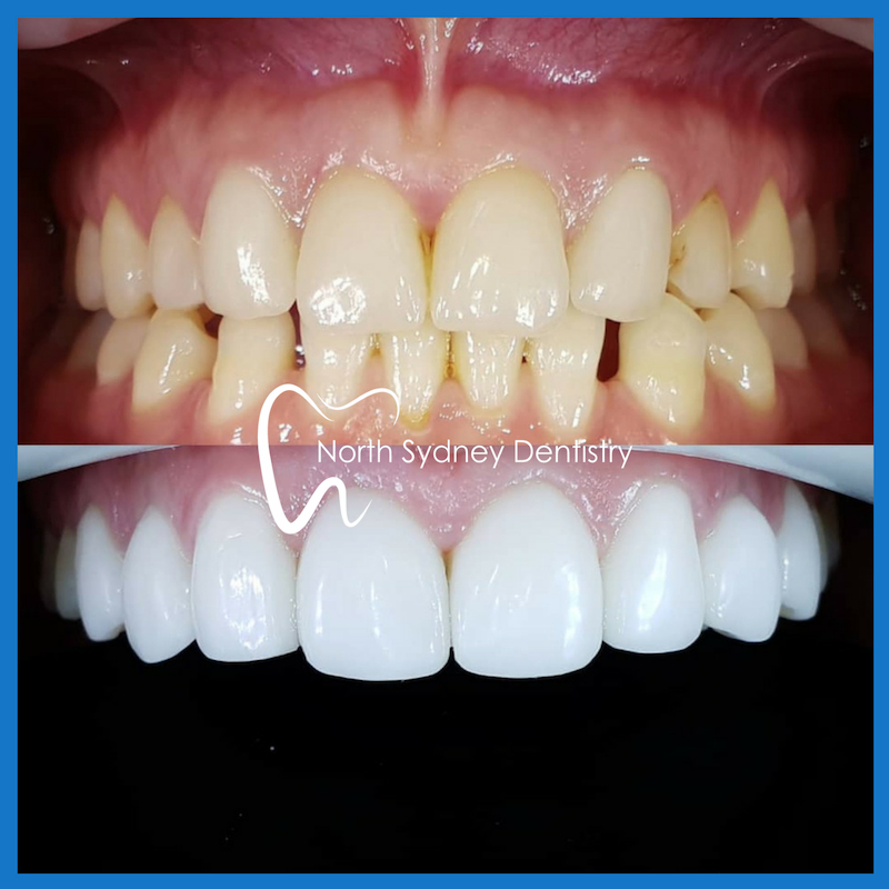 cosmetic dentistry
