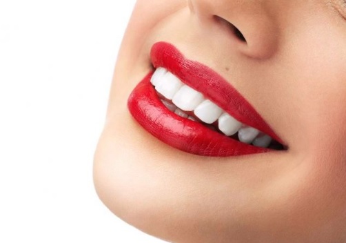 Teeth whitening in Sydney