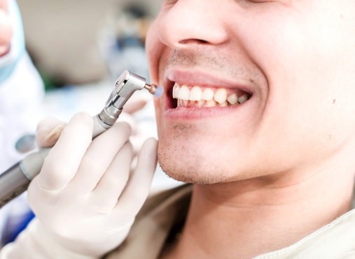 teeth cleaning in Sydney