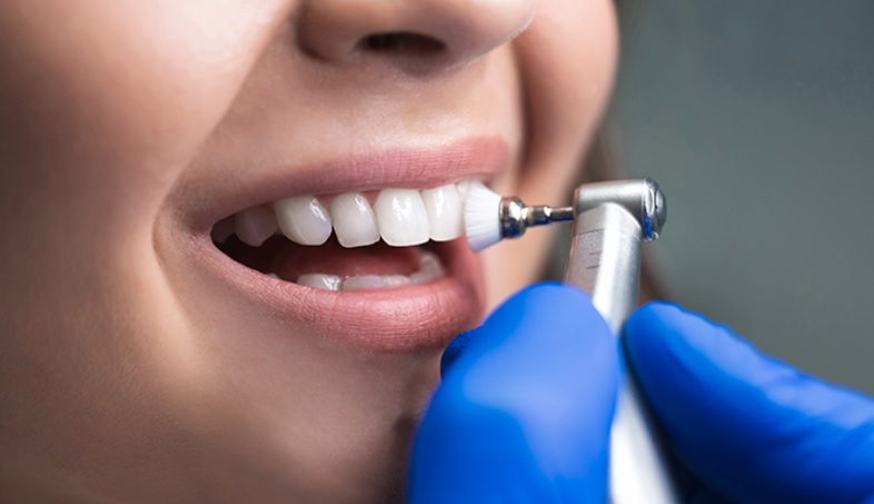 Teeth Cleaning Cost in Sydney