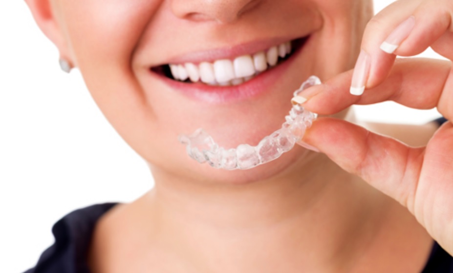 Invisalign cost