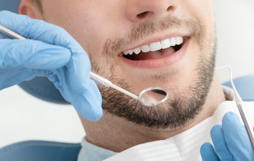 Which filling should I choose for my tooth? - Dentist in Sydney