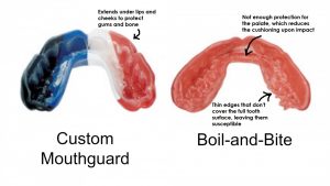 Mouthguard Sydney