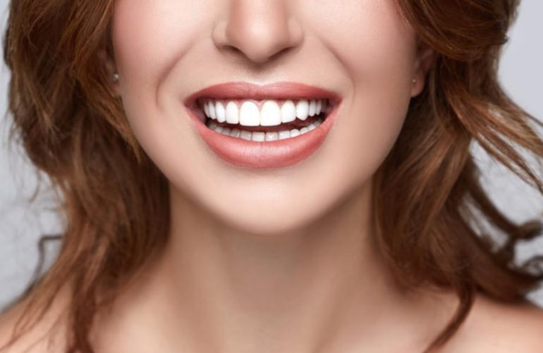 Veneers Cost