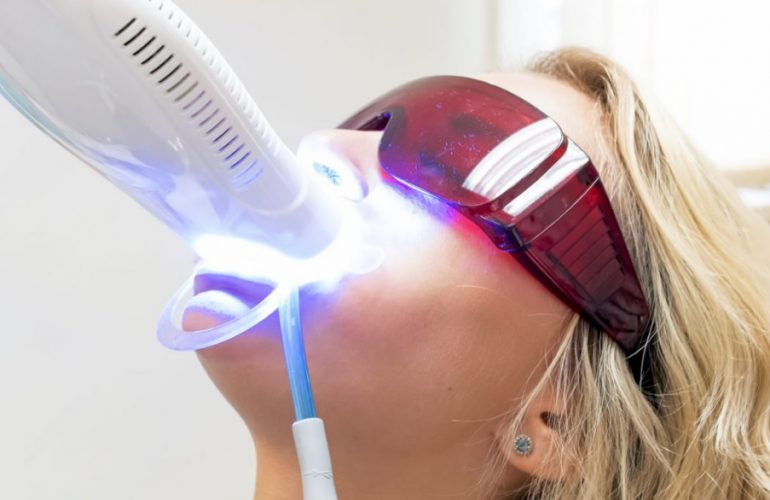 Teeth Whitening Near Me