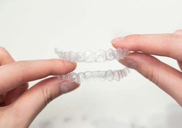 What is Invisalign