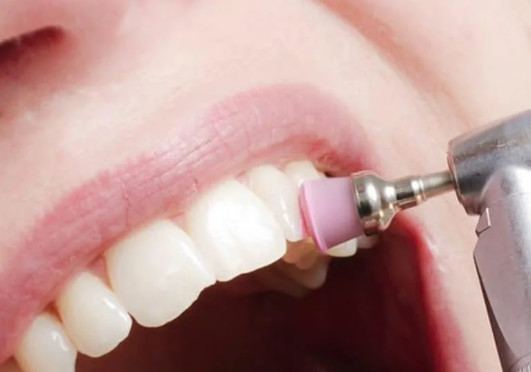Dental Cleaning Cost