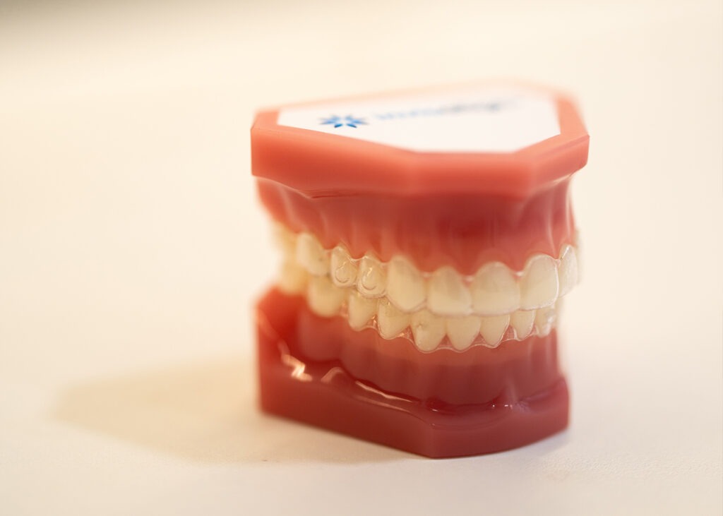 Model of upper and lower teeth