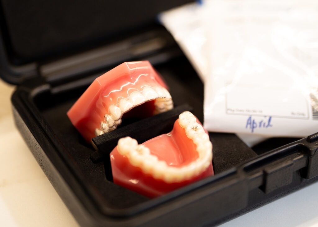 Invisalign available