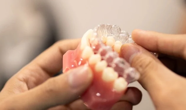 Clear aligner demonstrated on a dental model