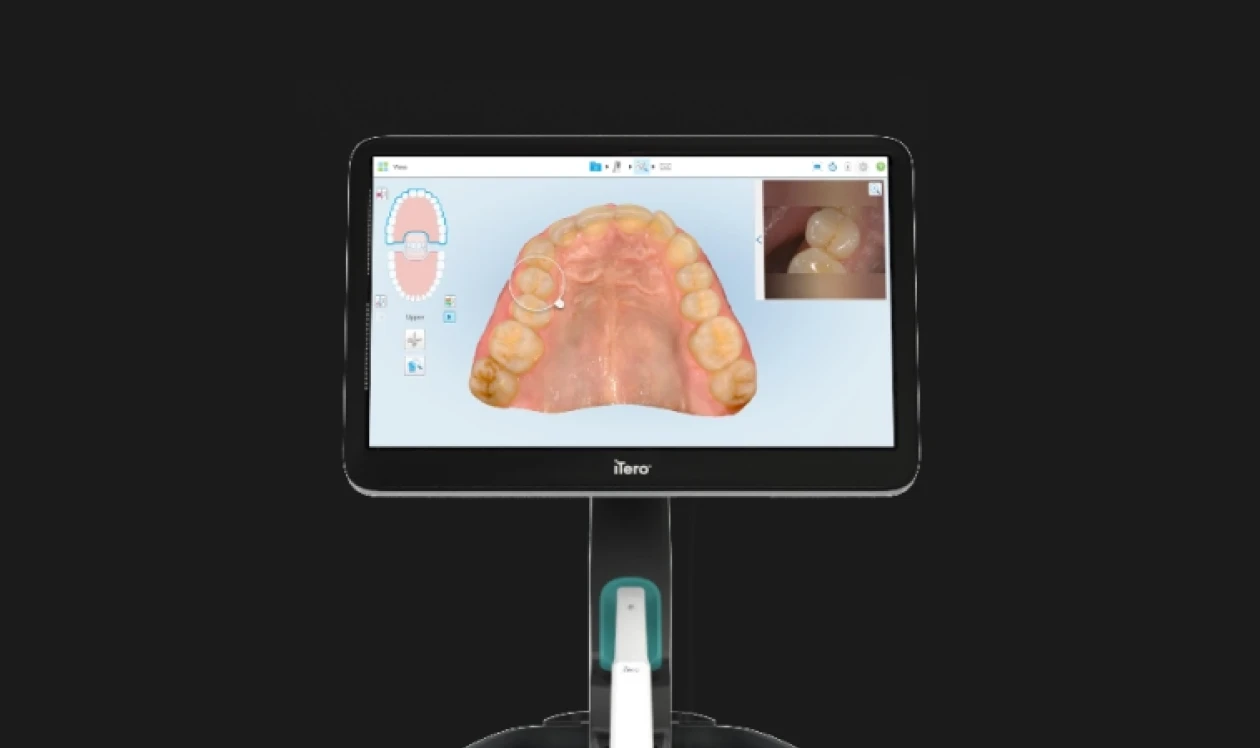 Intraoral scanner displaying a digital model of teeth