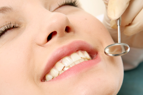 Professional Teeth Cleaning: What to Expect