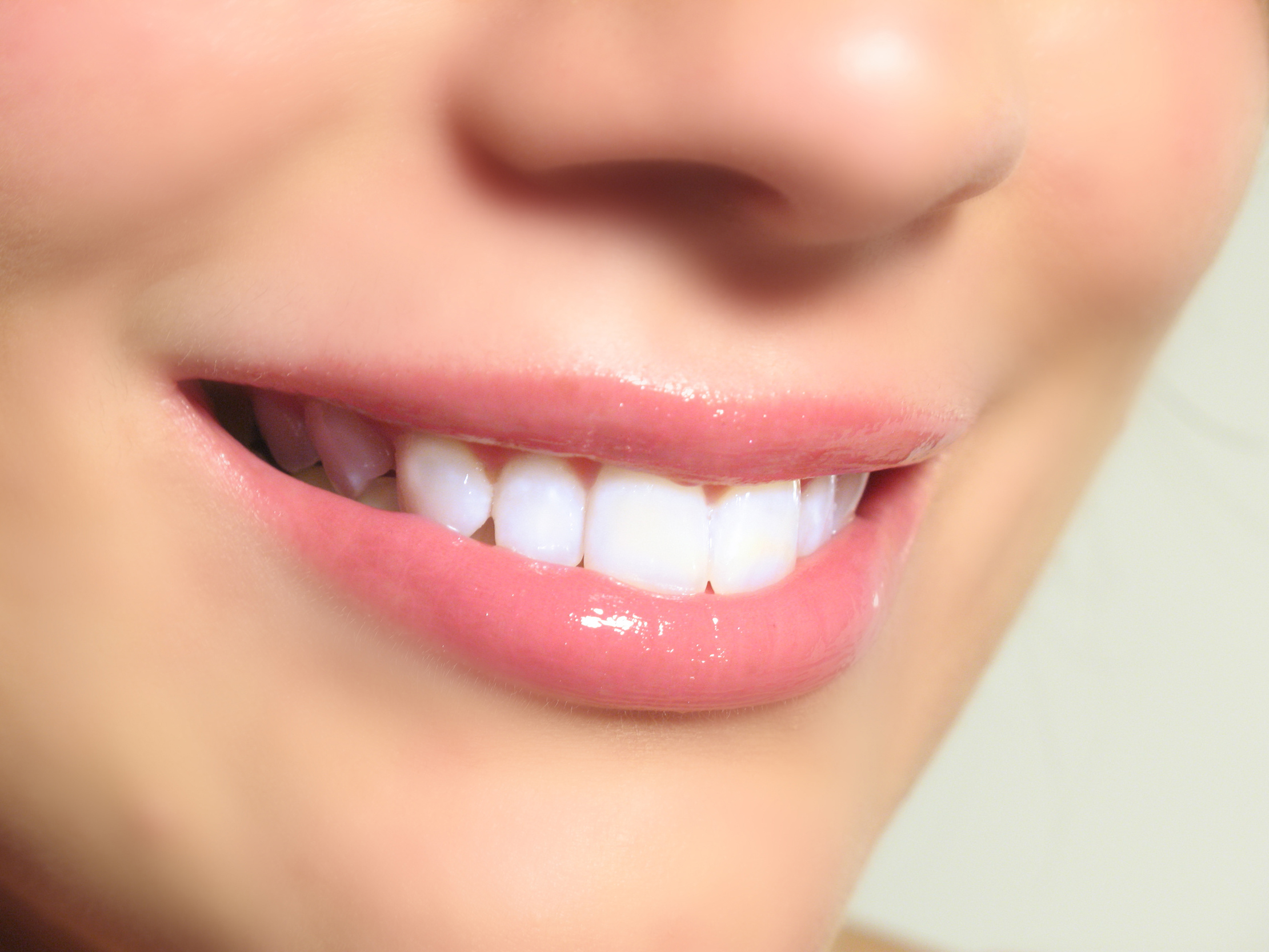 Considering Veneers: Benefits, Limits and Future Care