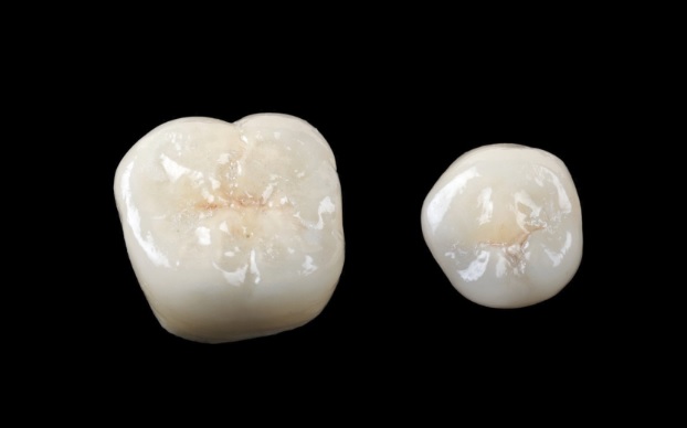 Porcelain Crowns: Materials and Considerations