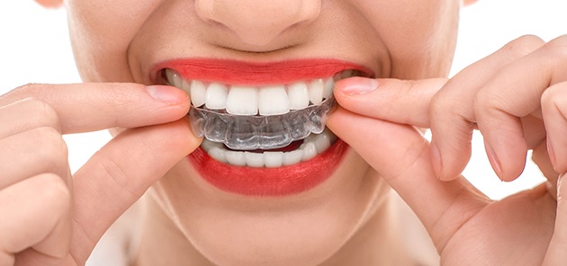 Choosing a Clinician for Clear Aligner Treatment