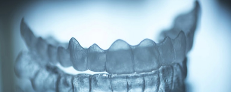 Clear Aligners: Daily Wear, Cleaning and Review