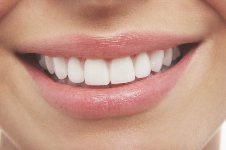 Professional Whitening: What the Process Involves