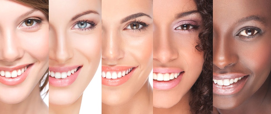 Professional Whitening: What the Process Involves