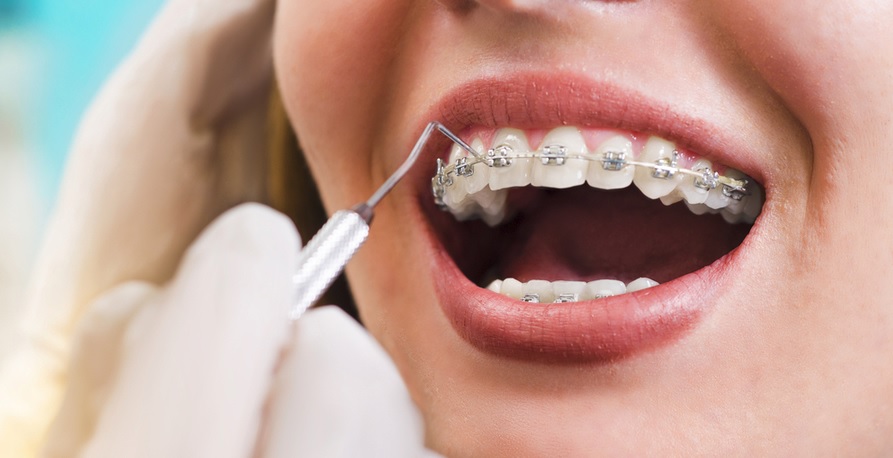 Orthodontic Assessment: Teeth, Bite and Treatment Options